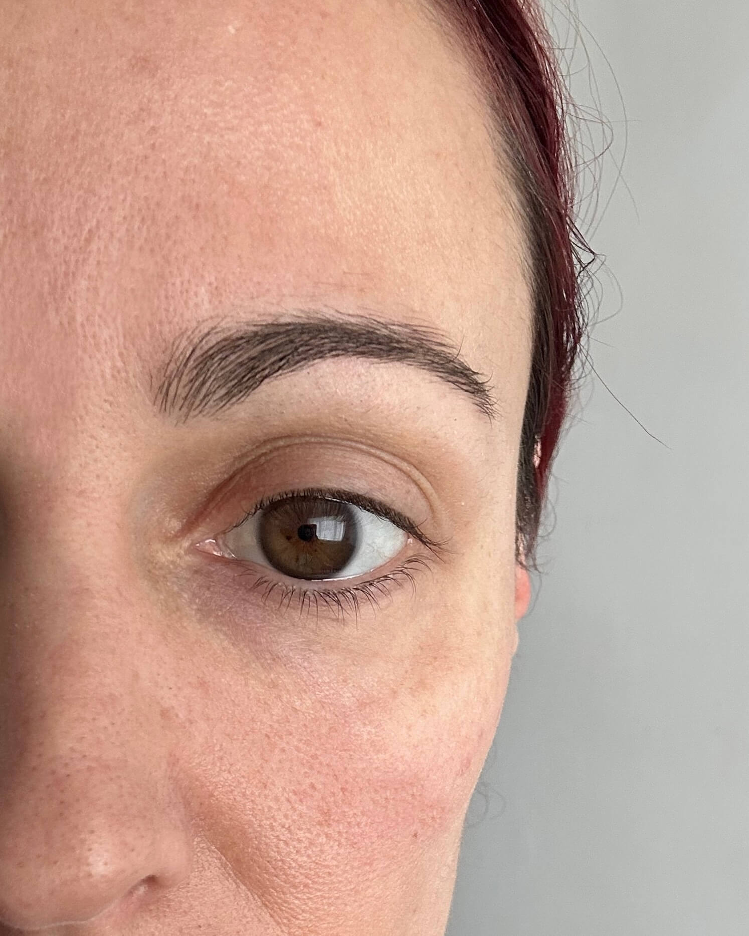 Eye after