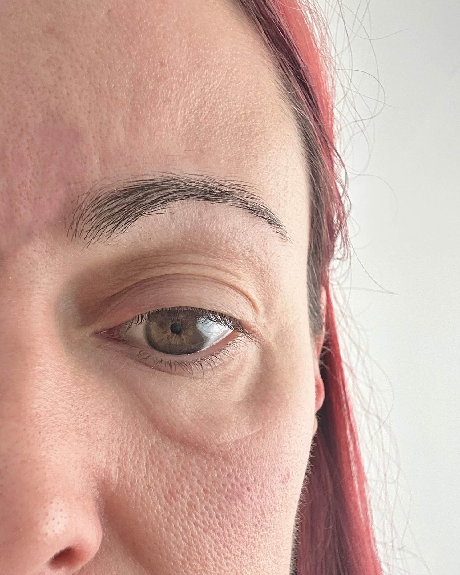 Eye before