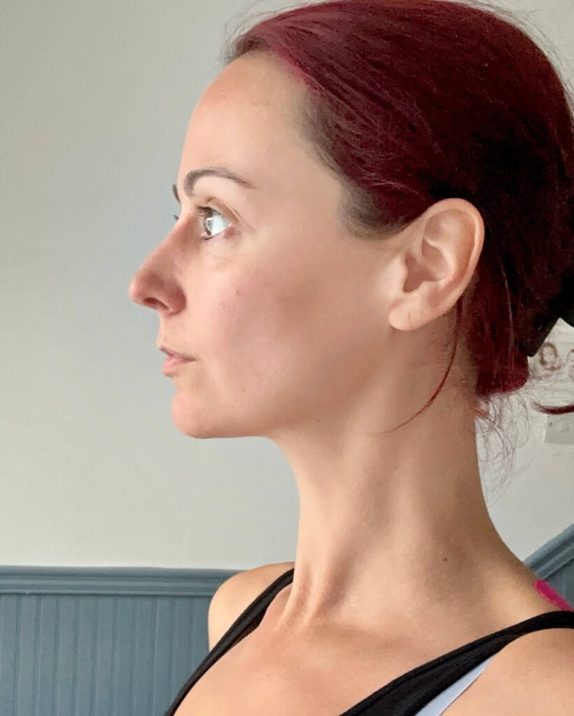 Neck after